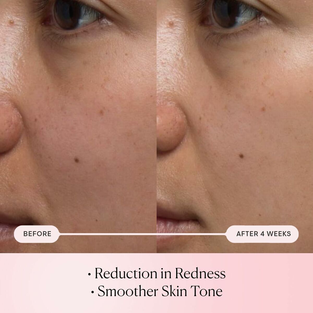 V2H0349EFBC088E1D49F8BFFF2C07C4C2D0R7702536P3