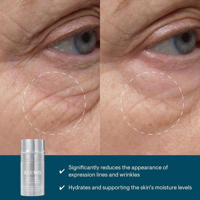 V2HB272E56F826E891337C769A9529555EDR7706327P1