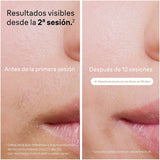 V2H41B4296A07281582C5631160297F81B6R7719975P3